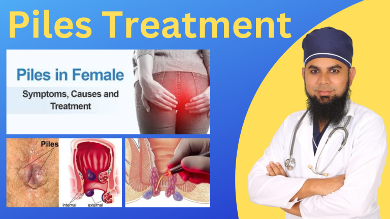 Treatment of Piles in Female