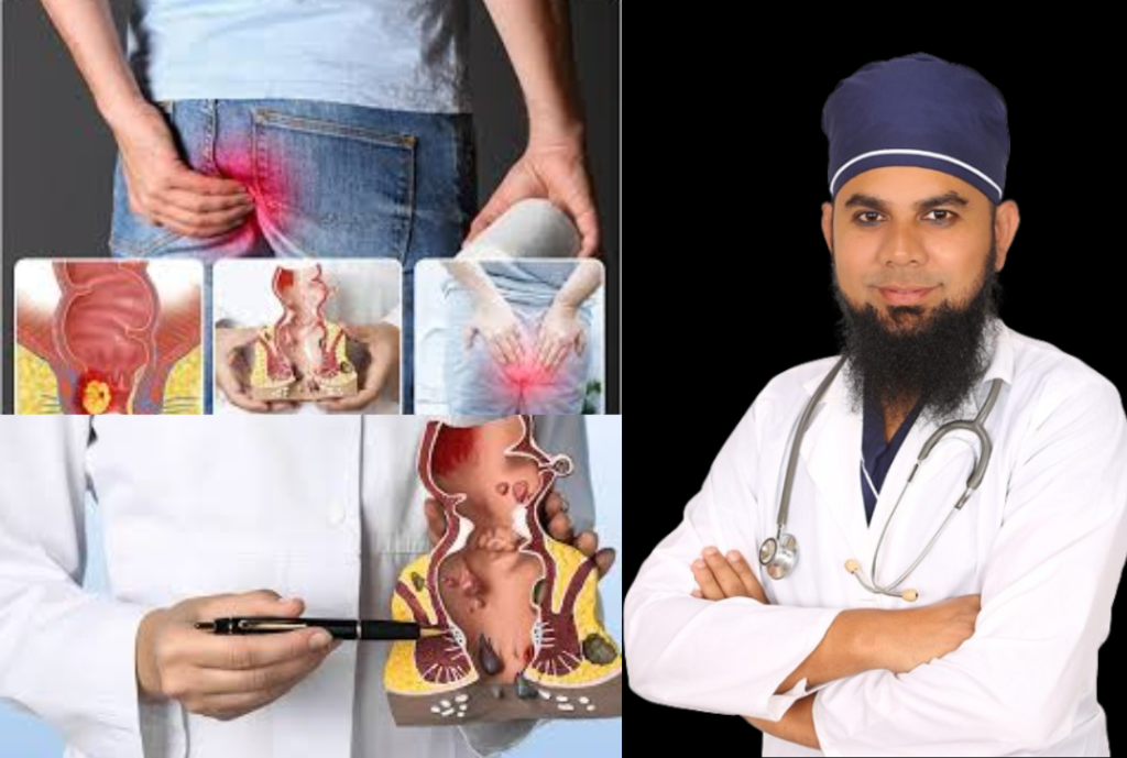 Piles Treatment BD
