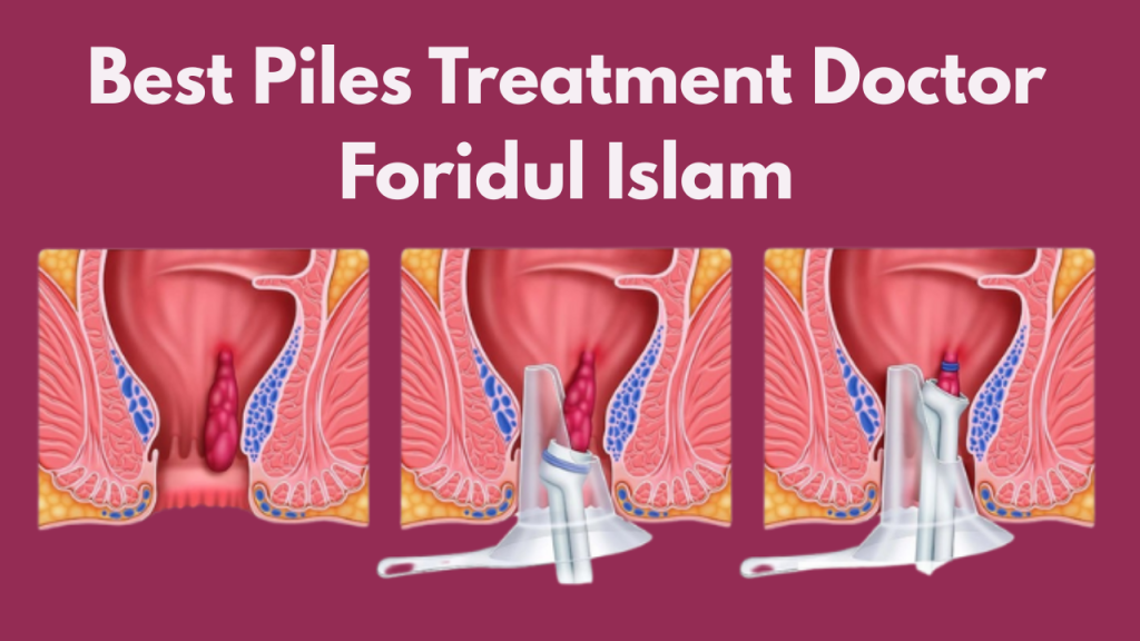 Best Piles Treatment Doctor Foridul Islam