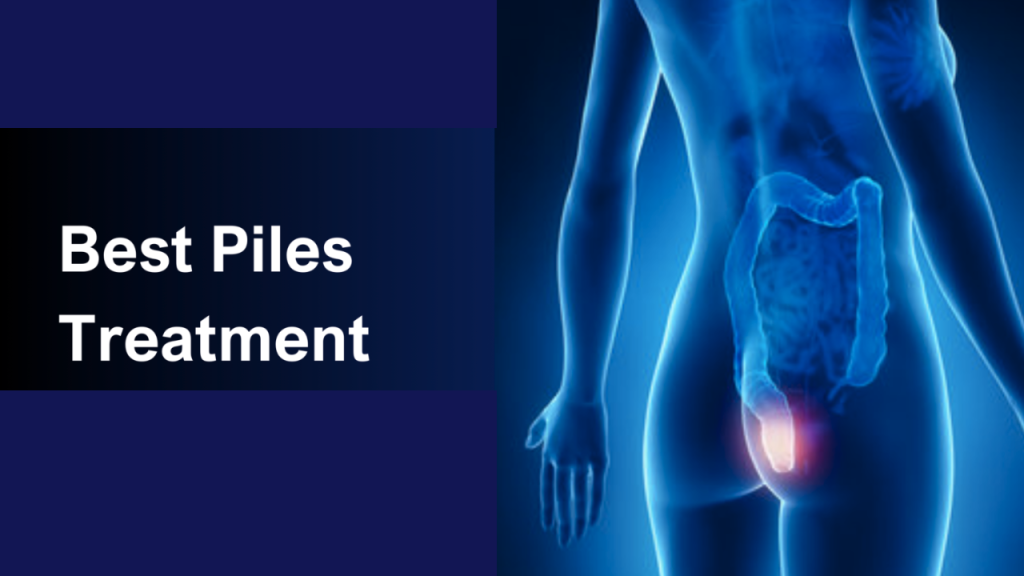 Piles Treatment